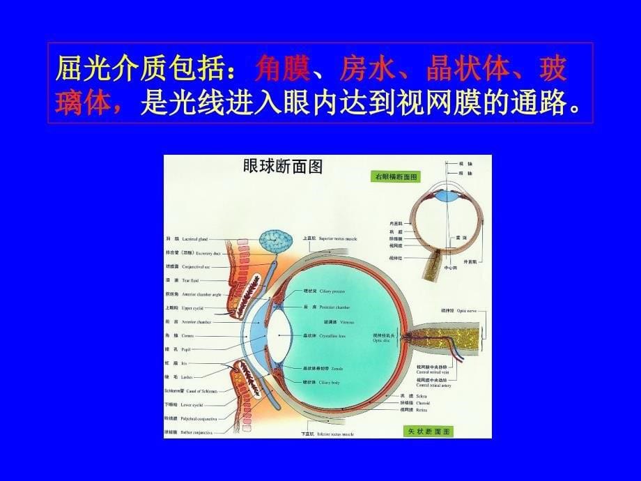 晶状体半脱位患儿护理_第5页