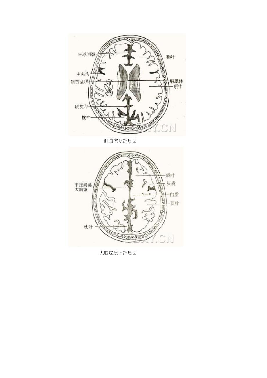 颅脑ct横断简明解剖_第4页