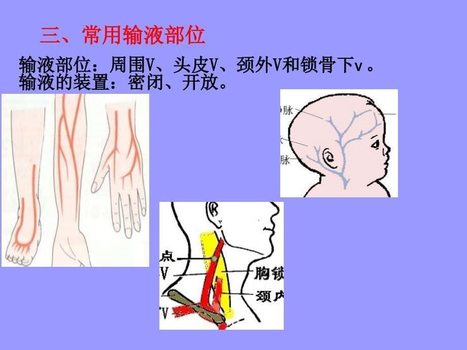 李淑芬静脉输液_第5页