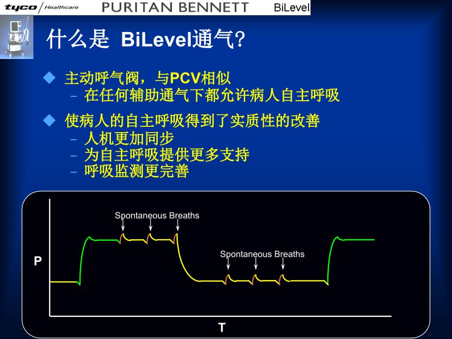 呼吸机通气模式-bliver_第2页