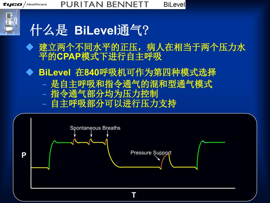 呼吸机通气模式-bliver_第3页