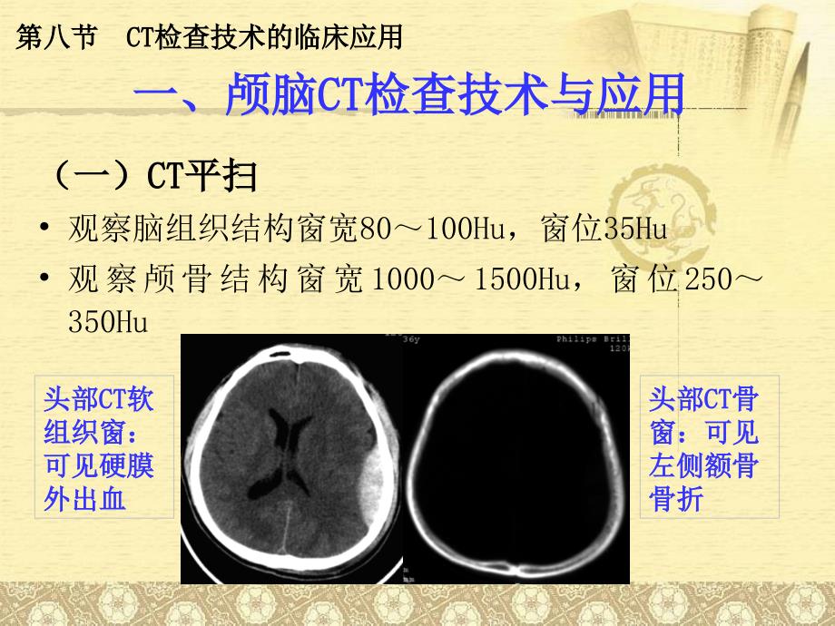 CT检查技术的临床应用_第4页