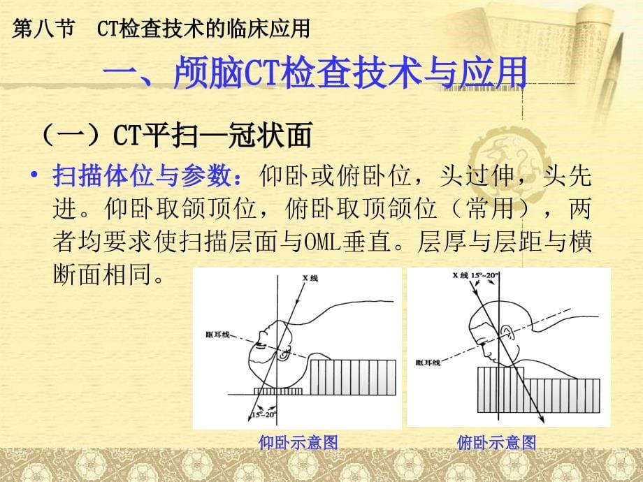 CT检查技术的临床应用_第5页