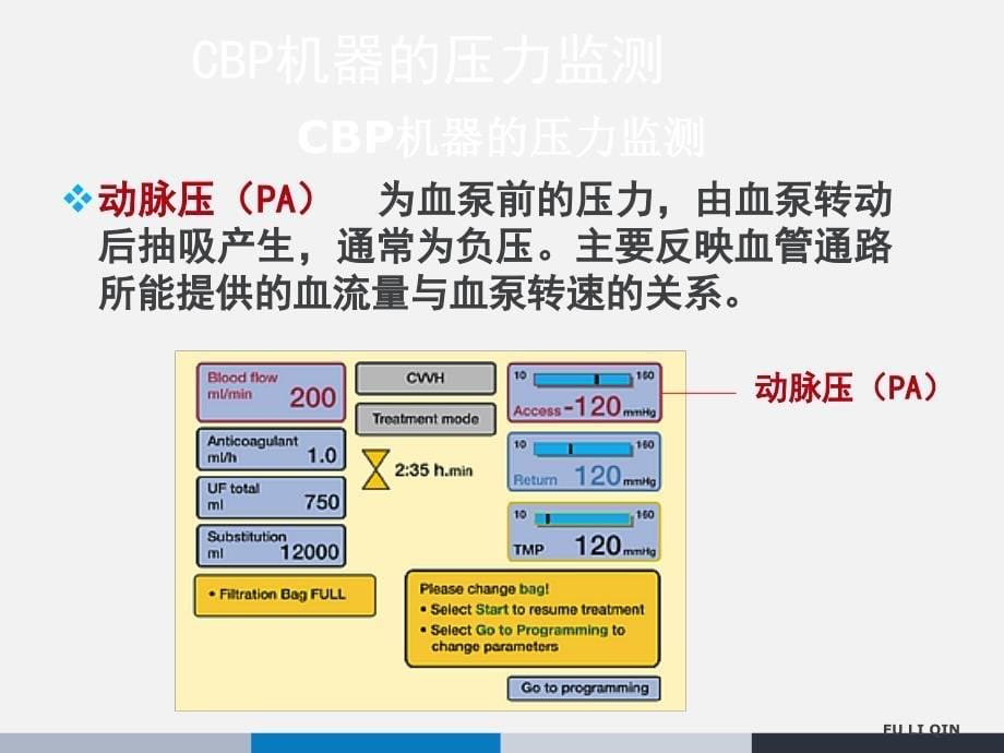 床边连续性血液净化的临床监测与护理_第5页