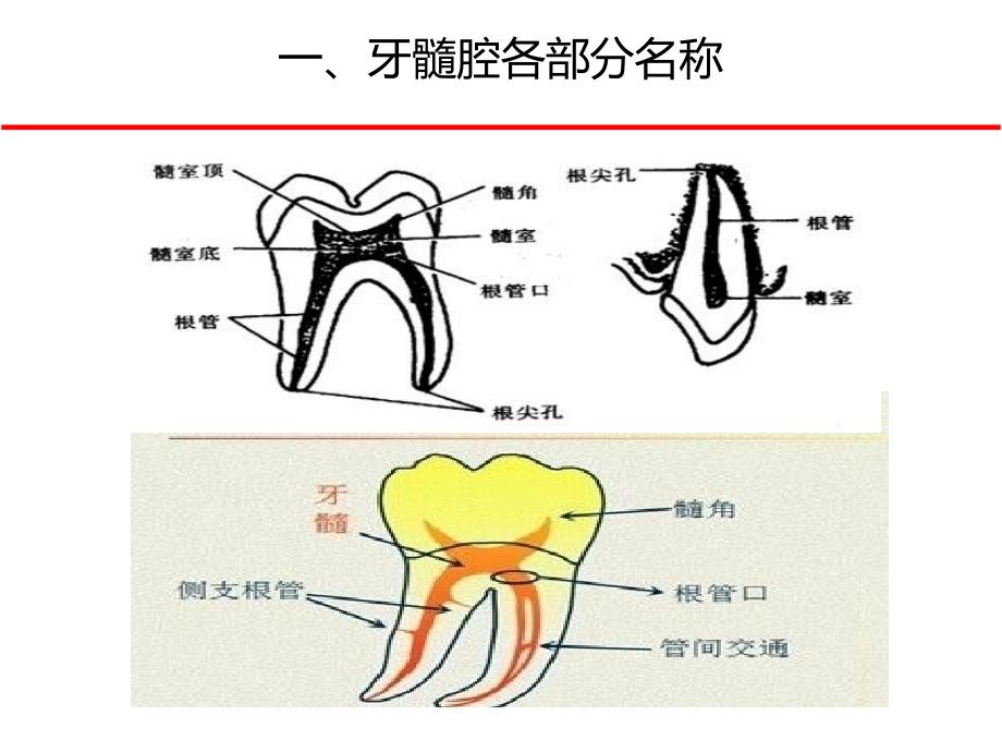 下颌磨牙髓腔解剖及开髓_第4页