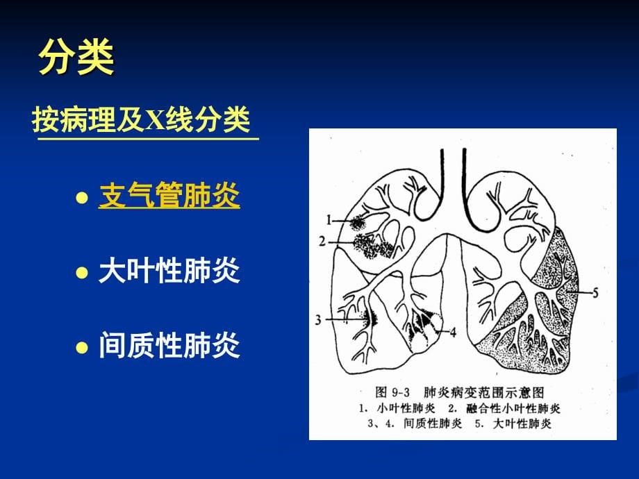 【专业课件】肺炎-支气管肺炎(1)_第5页