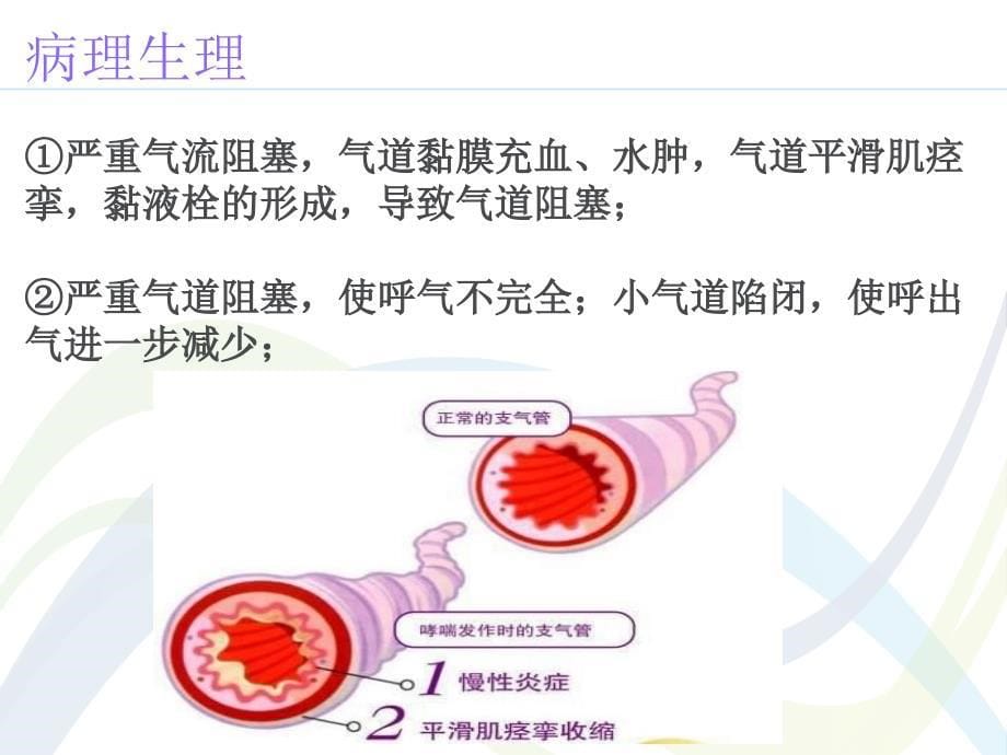 疑难病例讨论重症哮喘_第5页