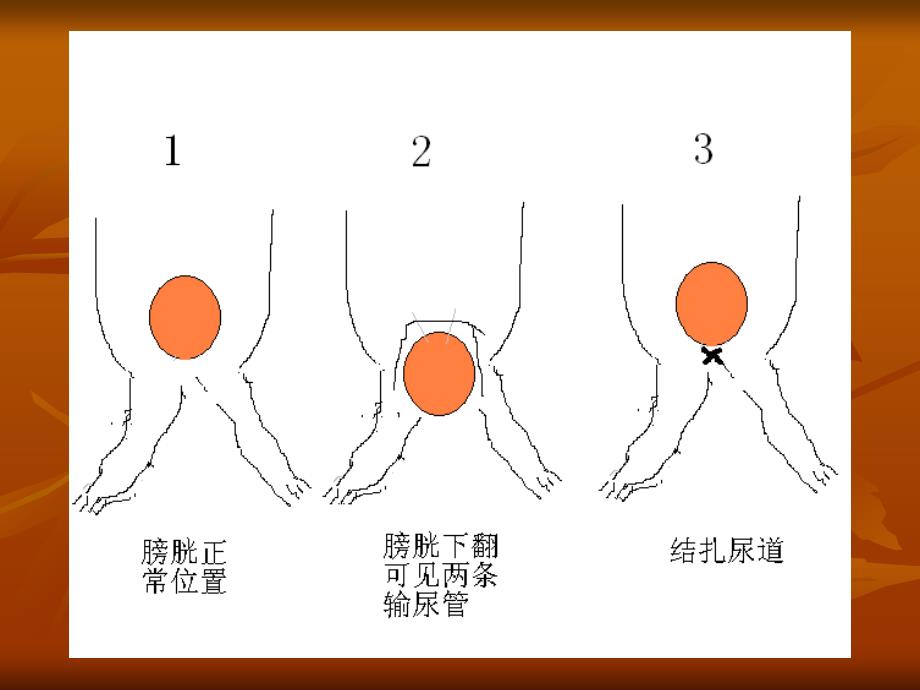 中医药大学人体解剖生理学课件jc整理-实验二 尿生成实验_第3页