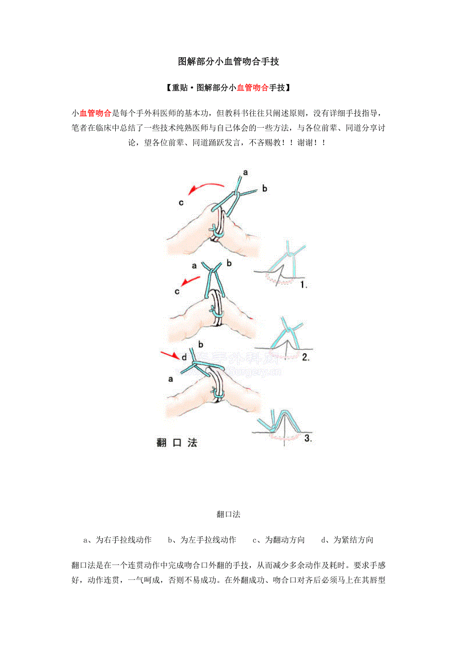 图解部分小血管吻合手技_第1页
