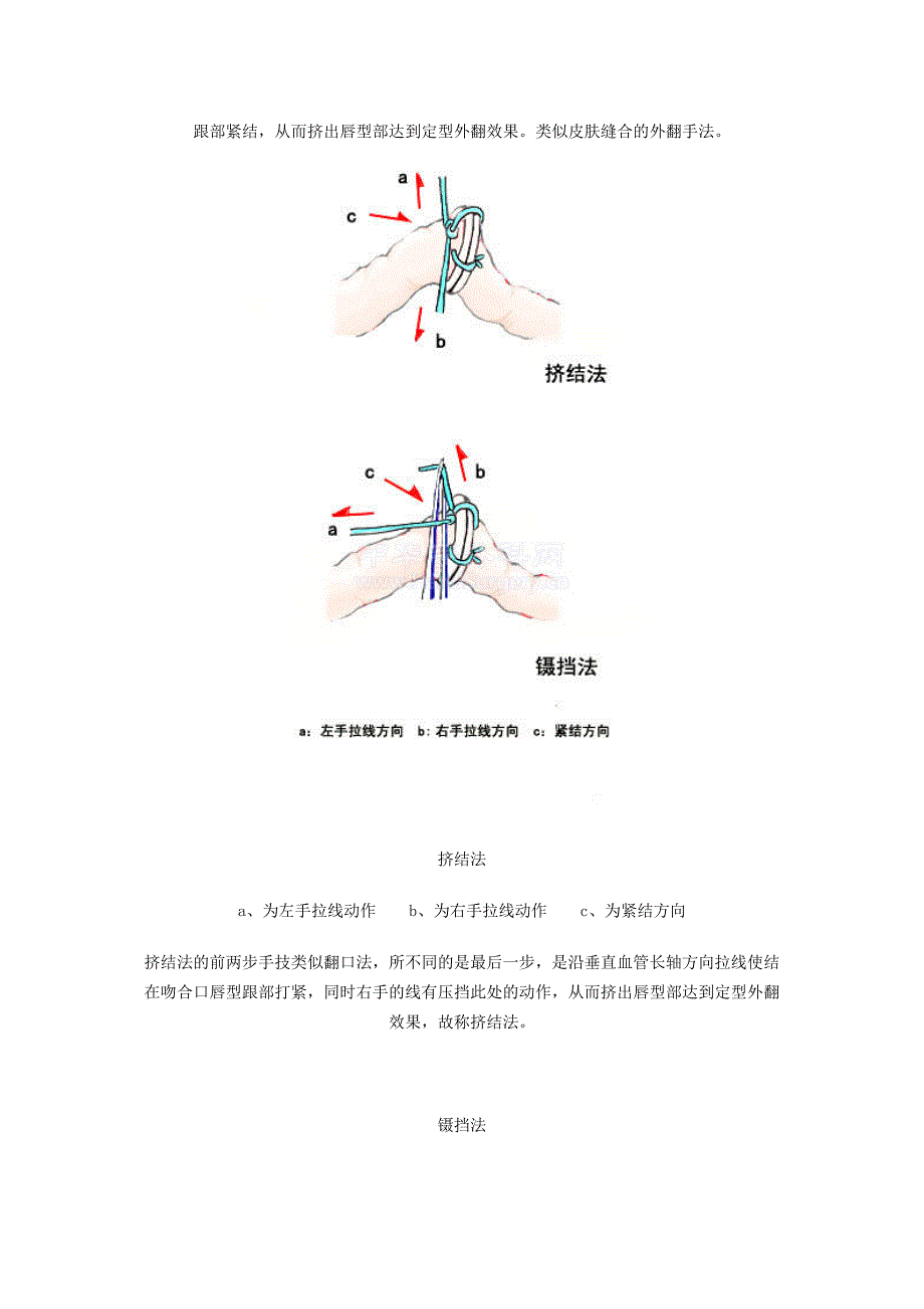 图解部分小血管吻合手技_第2页