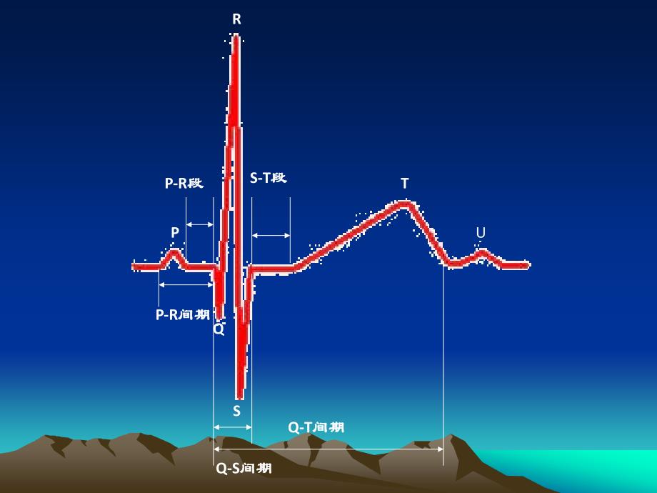 心电图检查基础—高传发_第3页