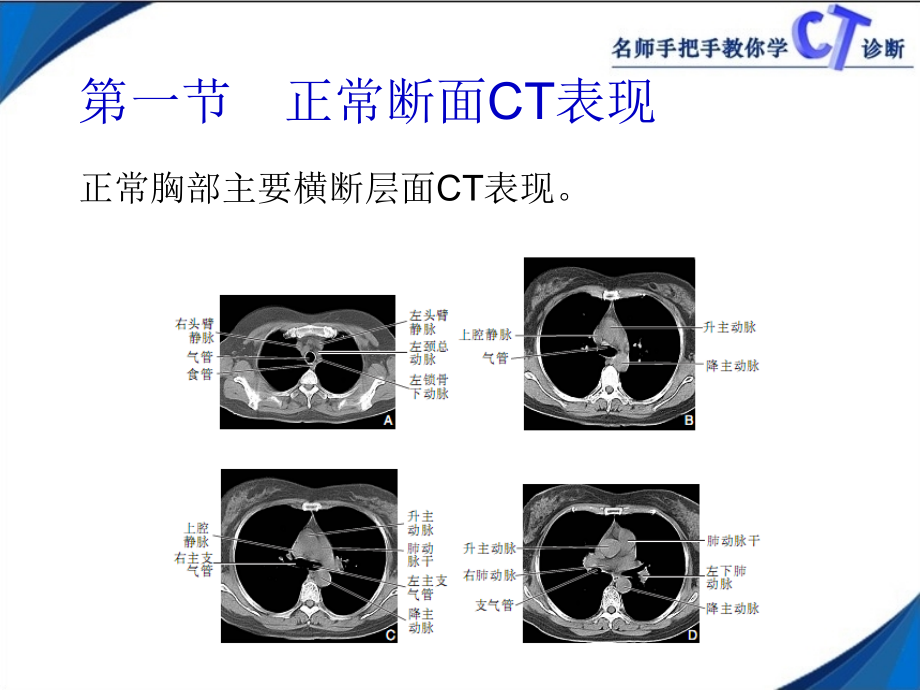 名师手把手教你学CT诊断 胸部_第2页