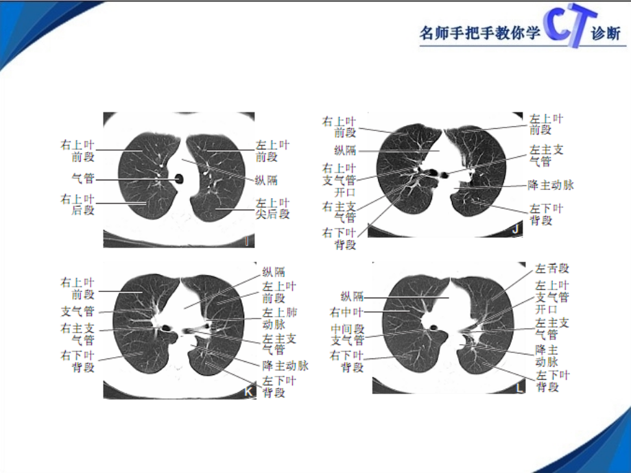 名师手把手教你学CT诊断 胸部_第4页