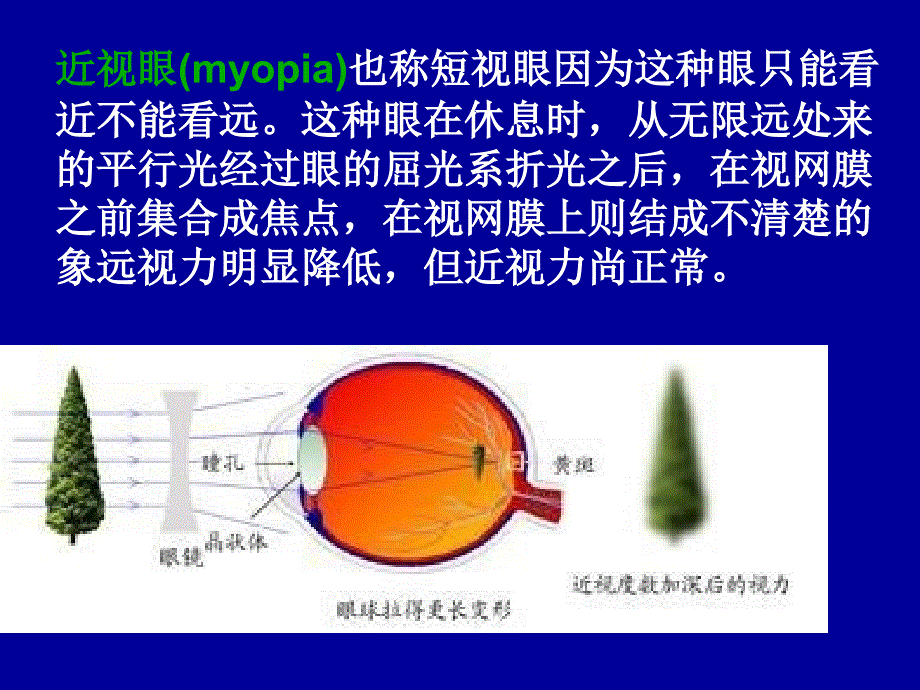 探寻近视成因_第4页