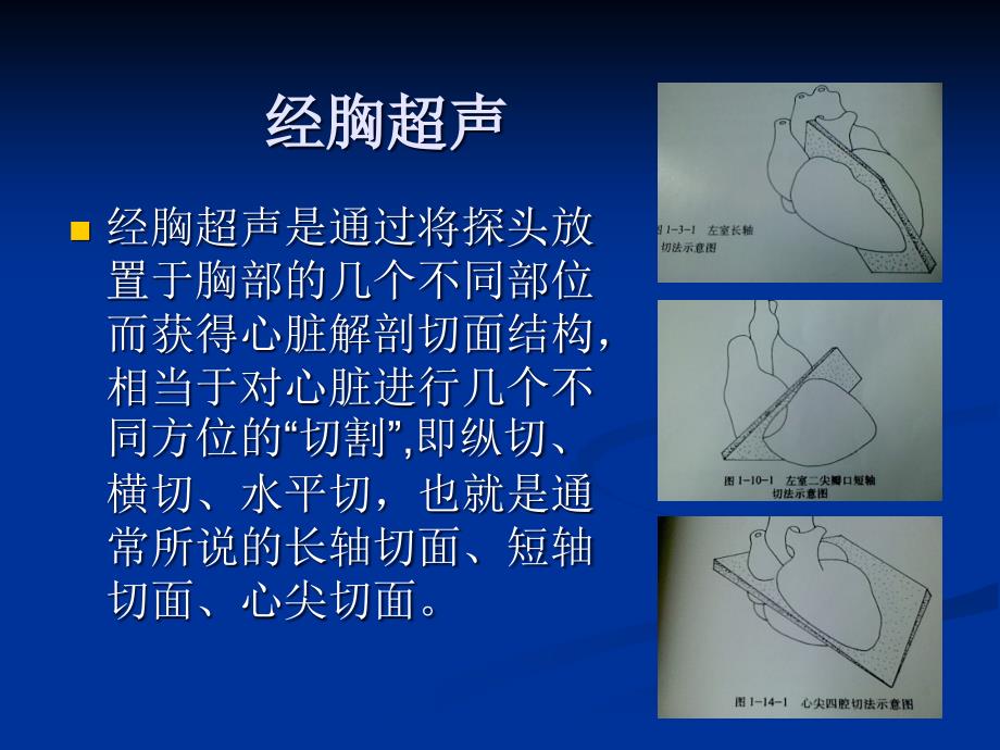 超声心动图基础知识和常用切面_第4页