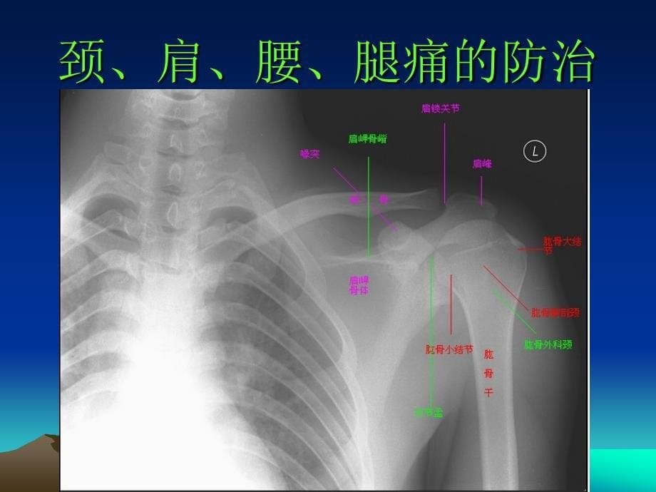 颈、肩、腰腿痛的防治_第5页