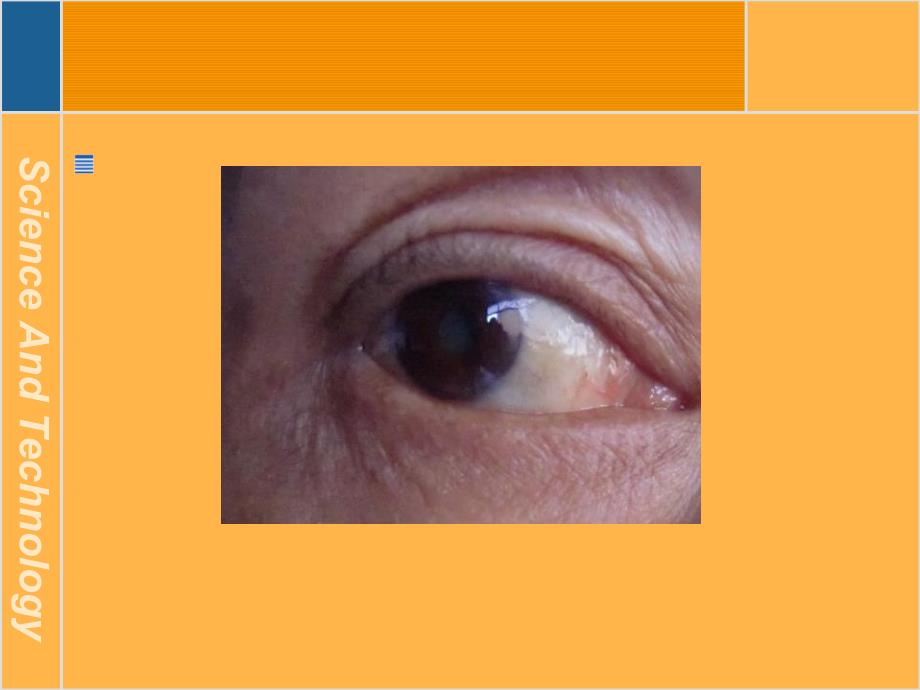 眼科耳科常见疾病关联用药及提升技巧_第3页