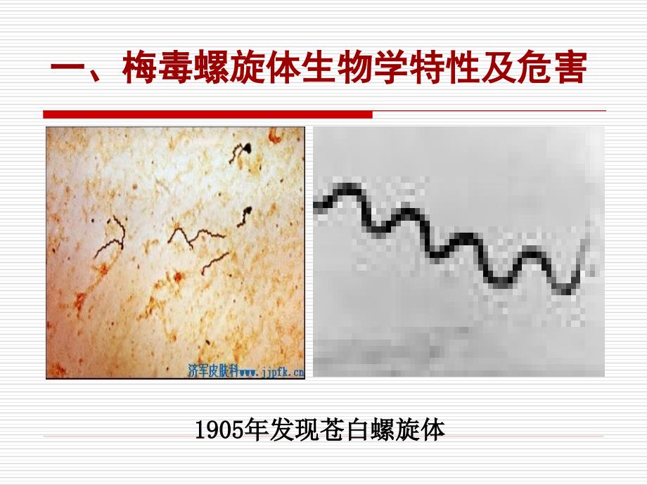 妊娠期梅毒的规范治疗_第3页