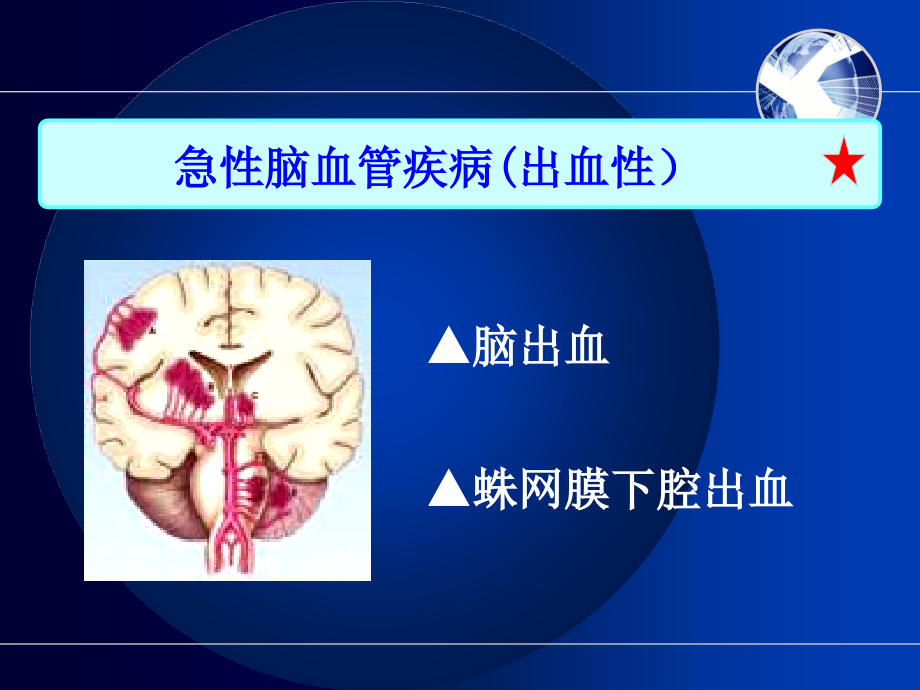 脑出血的护理1幻灯片 (1)_第3页