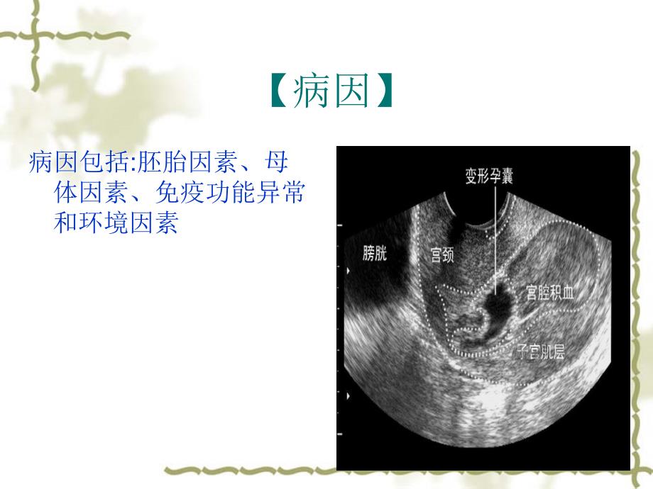 妊娠时限异常_第2页