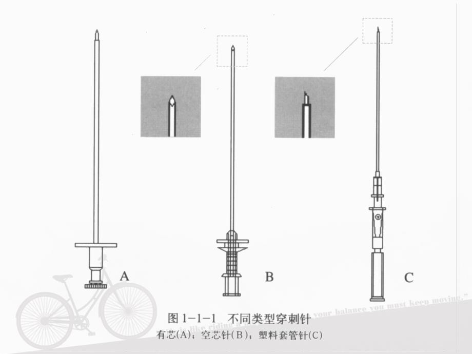 经皮穿刺术-基本技术_第4页