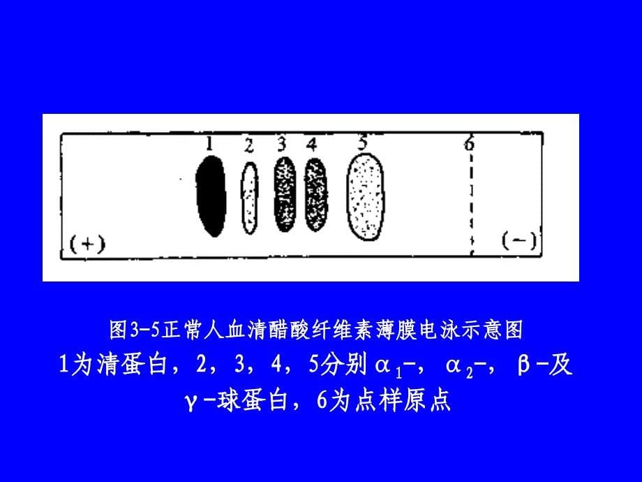 实验十血清蛋白的醋酸纤维薄膜电泳_第5页