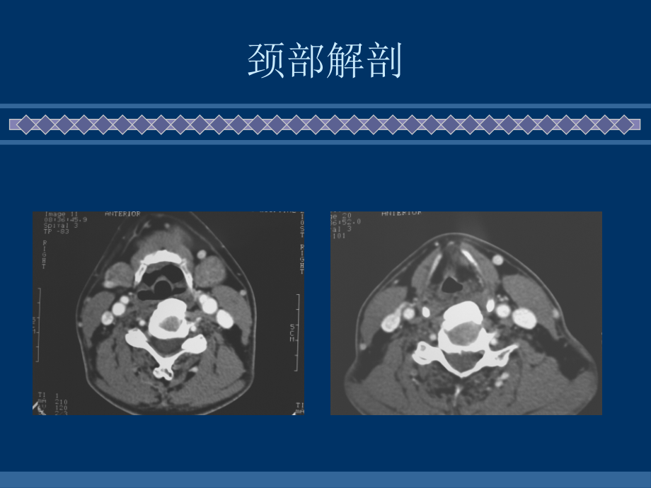 颈部肿块病变的诊断和鉴别诊断_第4页