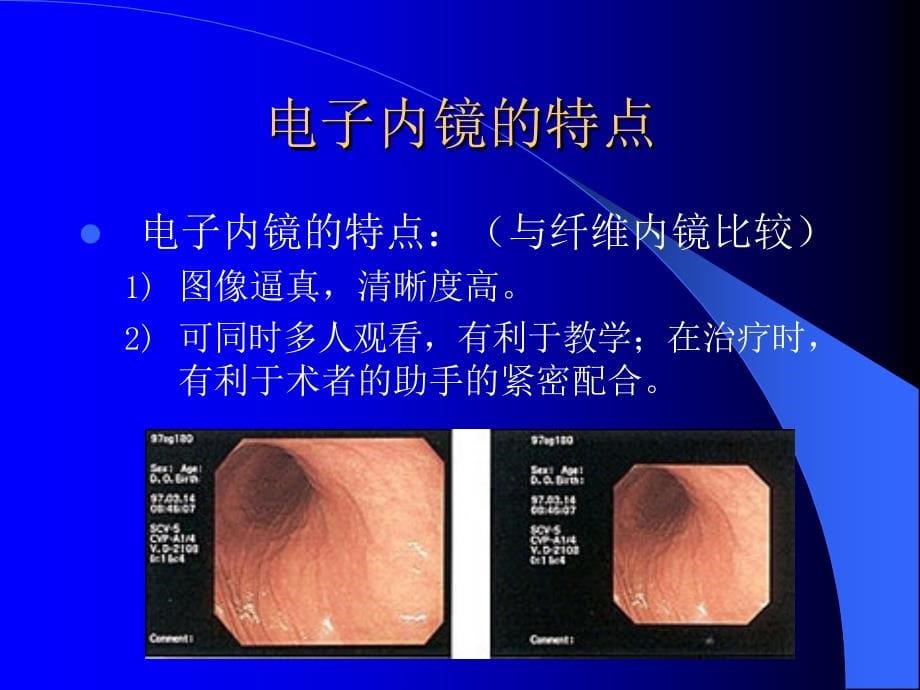 消化道内镜的临床应用_第5页