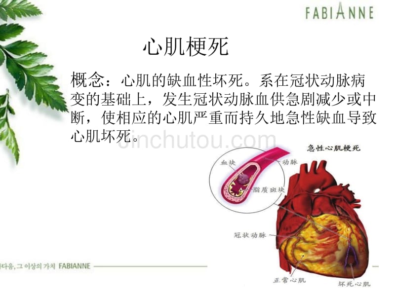 [医学]心肌梗死教学查房_第4页