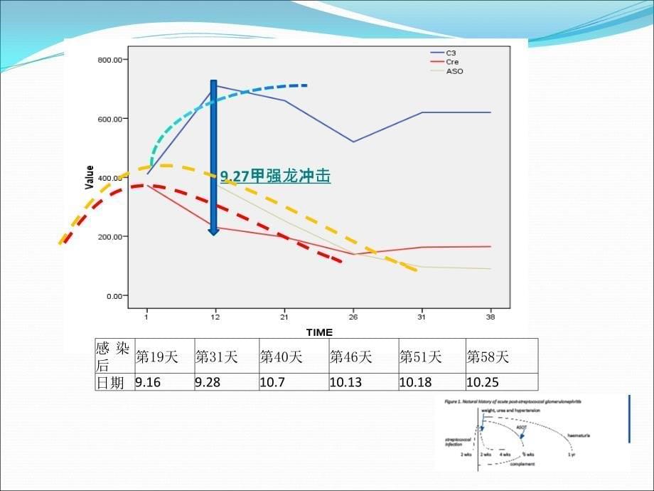 急性感染后新月体肾炎_第5页