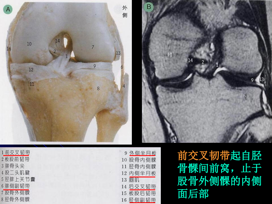 膝关节解剖及MRI诊断_第3页
