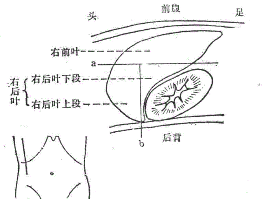 腹部超声诊断改_第3页