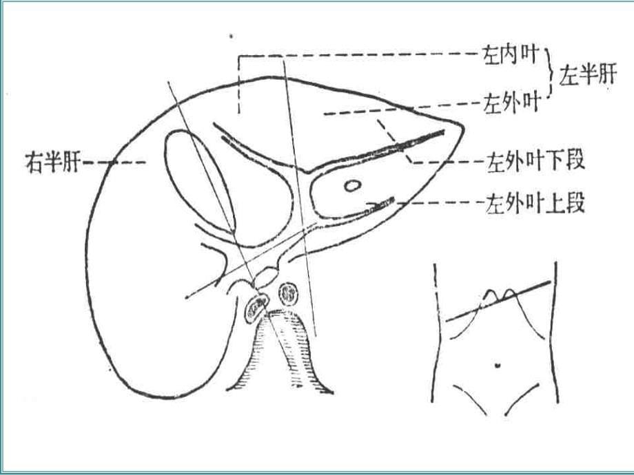 腹部超声诊断改_第5页