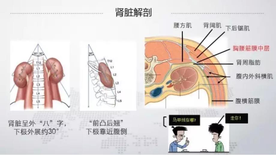 超声定位标准经皮肾镜穿刺技术_第4页