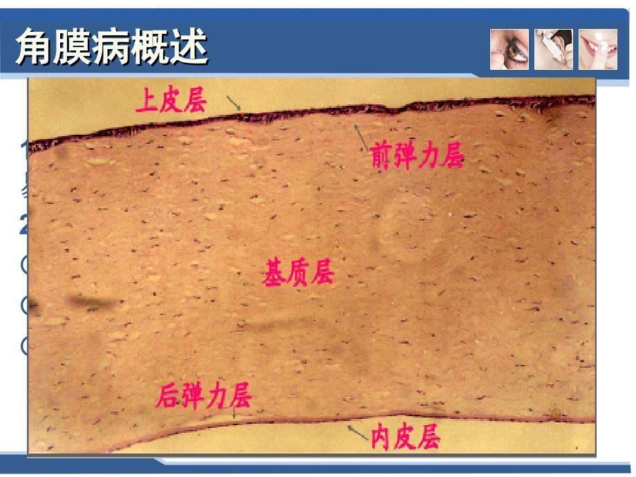 五官科学-第三章眼科常见疾病4角膜病与巩膜病_第3页