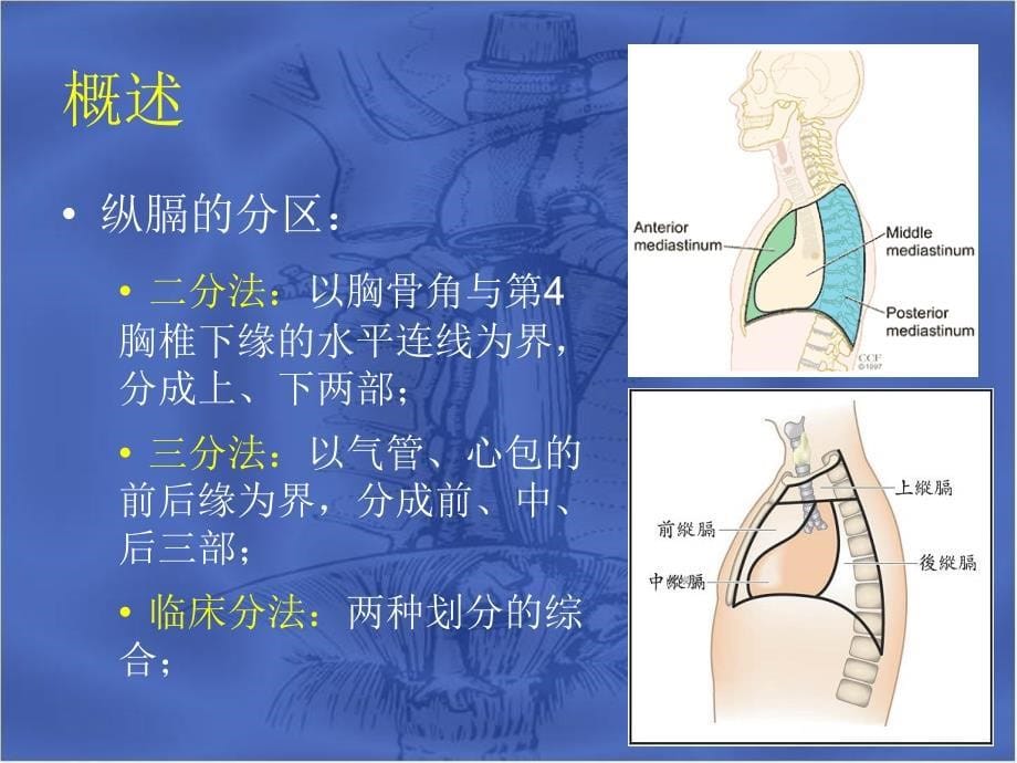 原发性纵膈肿瘤_第5页