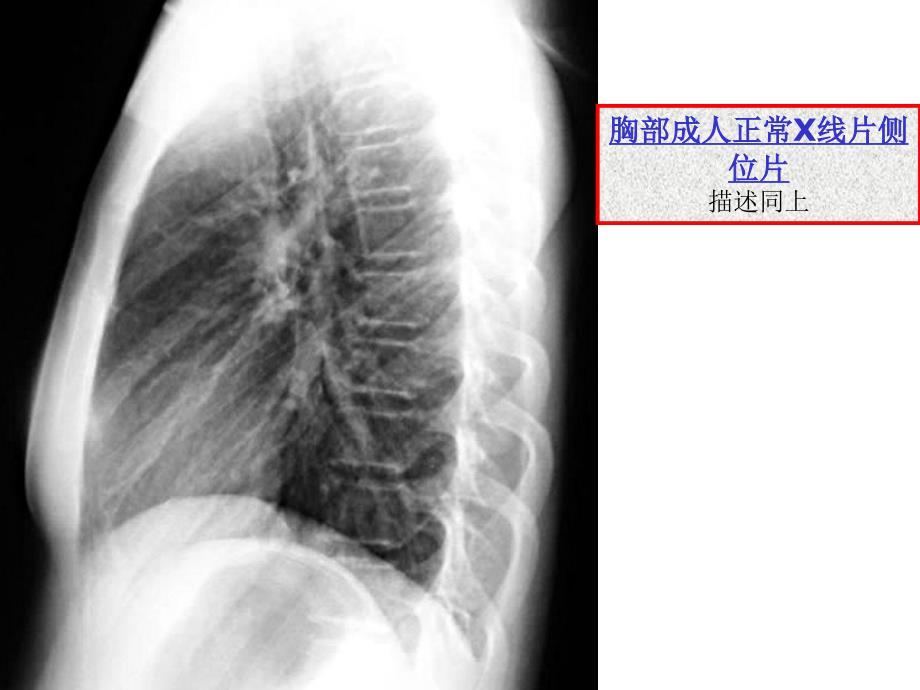 执业医师技能考试X线诊断_第3页