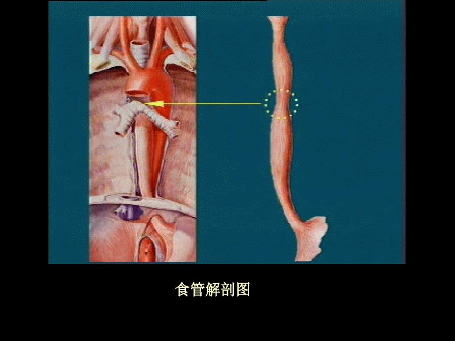 胃食管反流病内科学_第3页