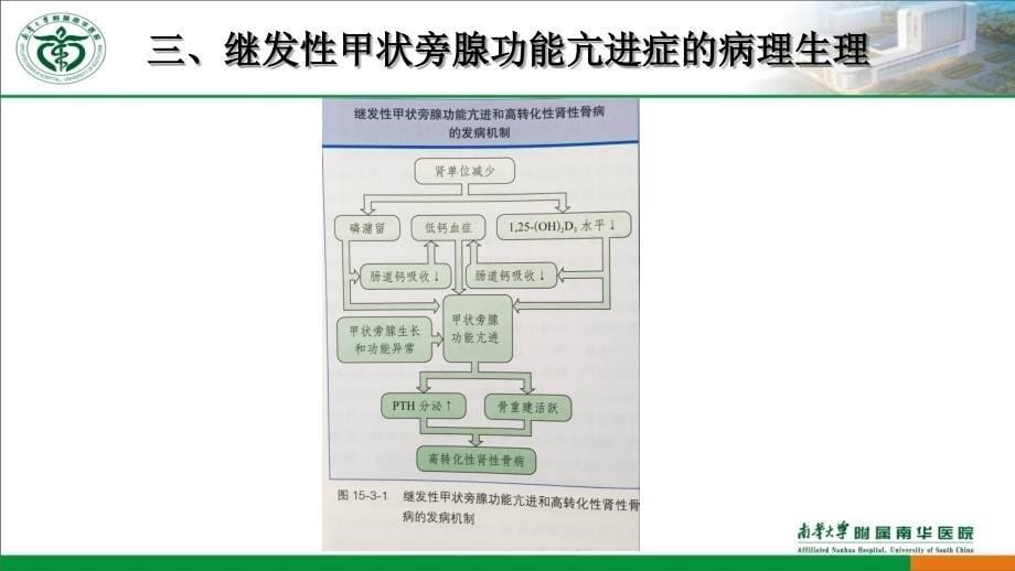 尿毒症继发性甲旁亢的处理_第5页