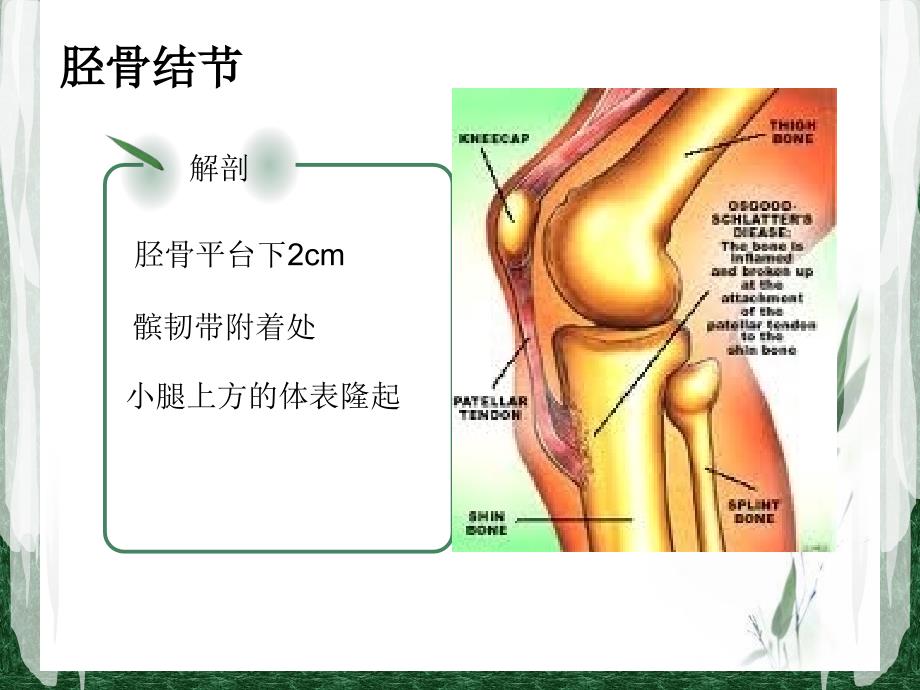 胫骨结节骨软骨炎_第2页