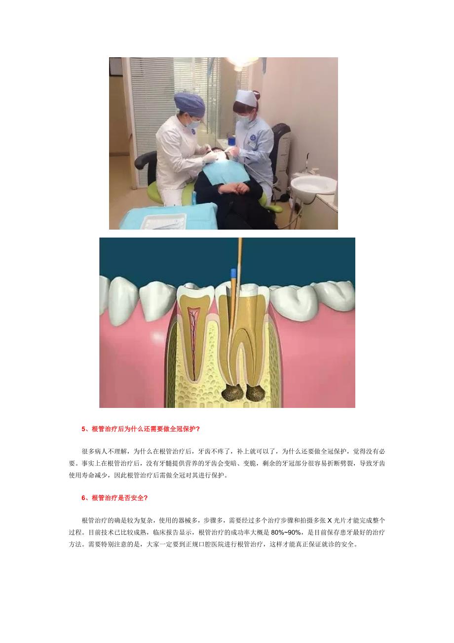 根管治疗是不是就是我们常说的抽牙神经？_第4页