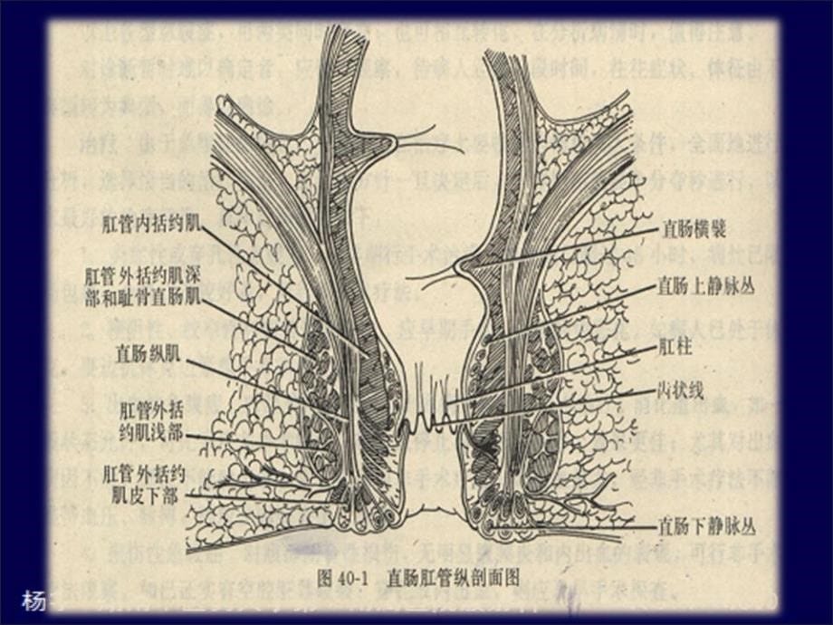 肛周脓肿的mr表现和检查技术_第5页