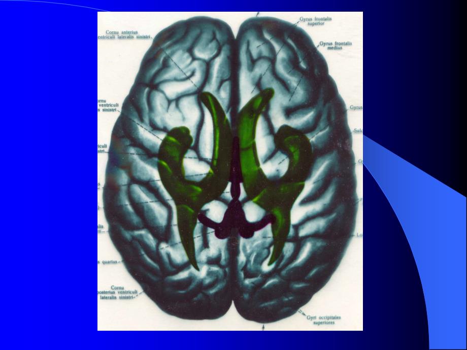 [医学]断层解剖学----脑室和脑池_第3页