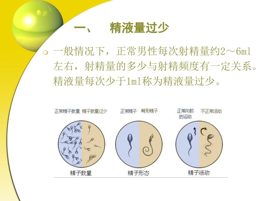 精子精液异常有哪些类型_第2页