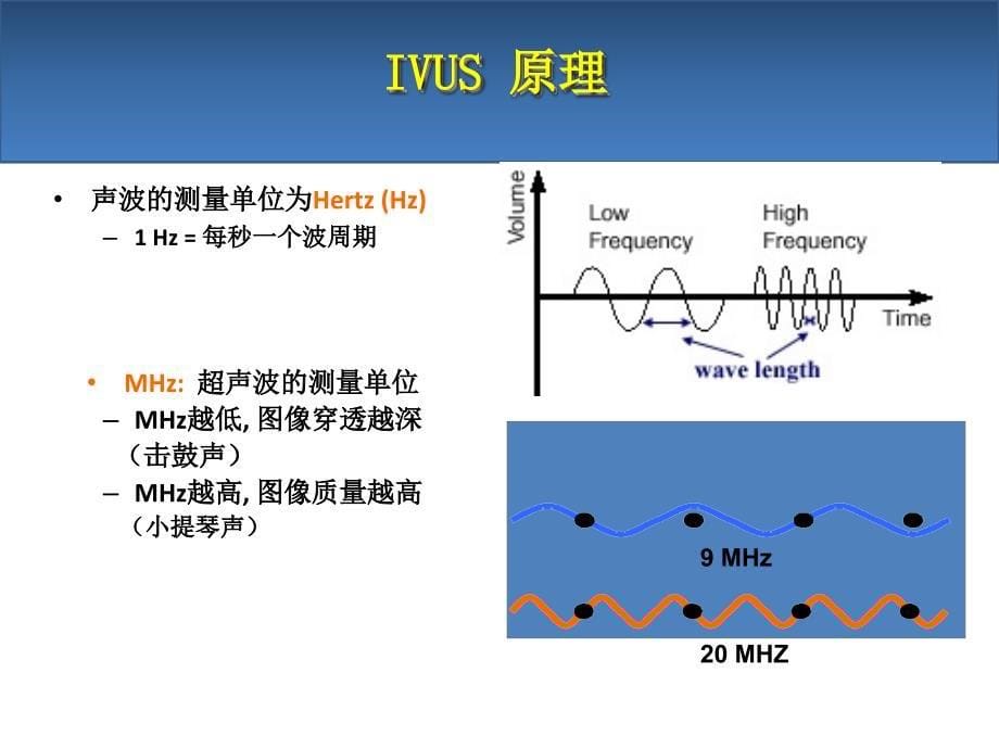 血管内超声IVUS简介_第5页