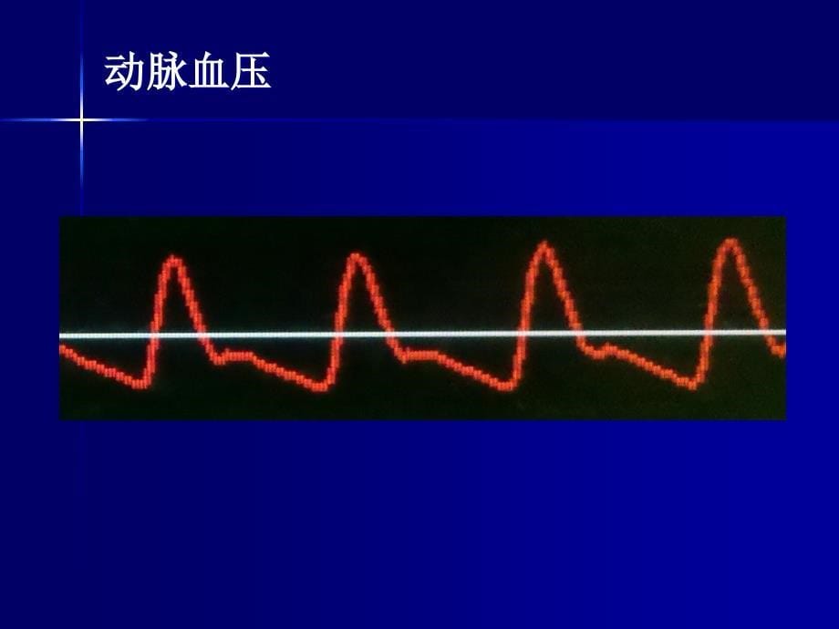 [医药]血流动力学监测_第5页