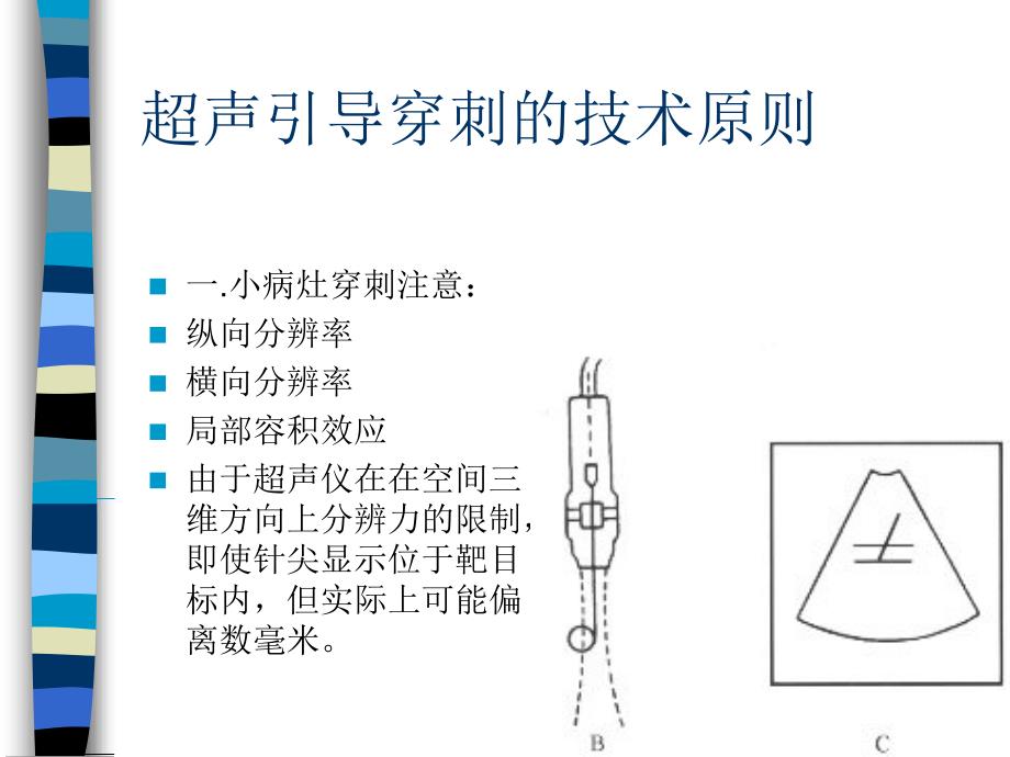 介入性超声的临床应用_第3页