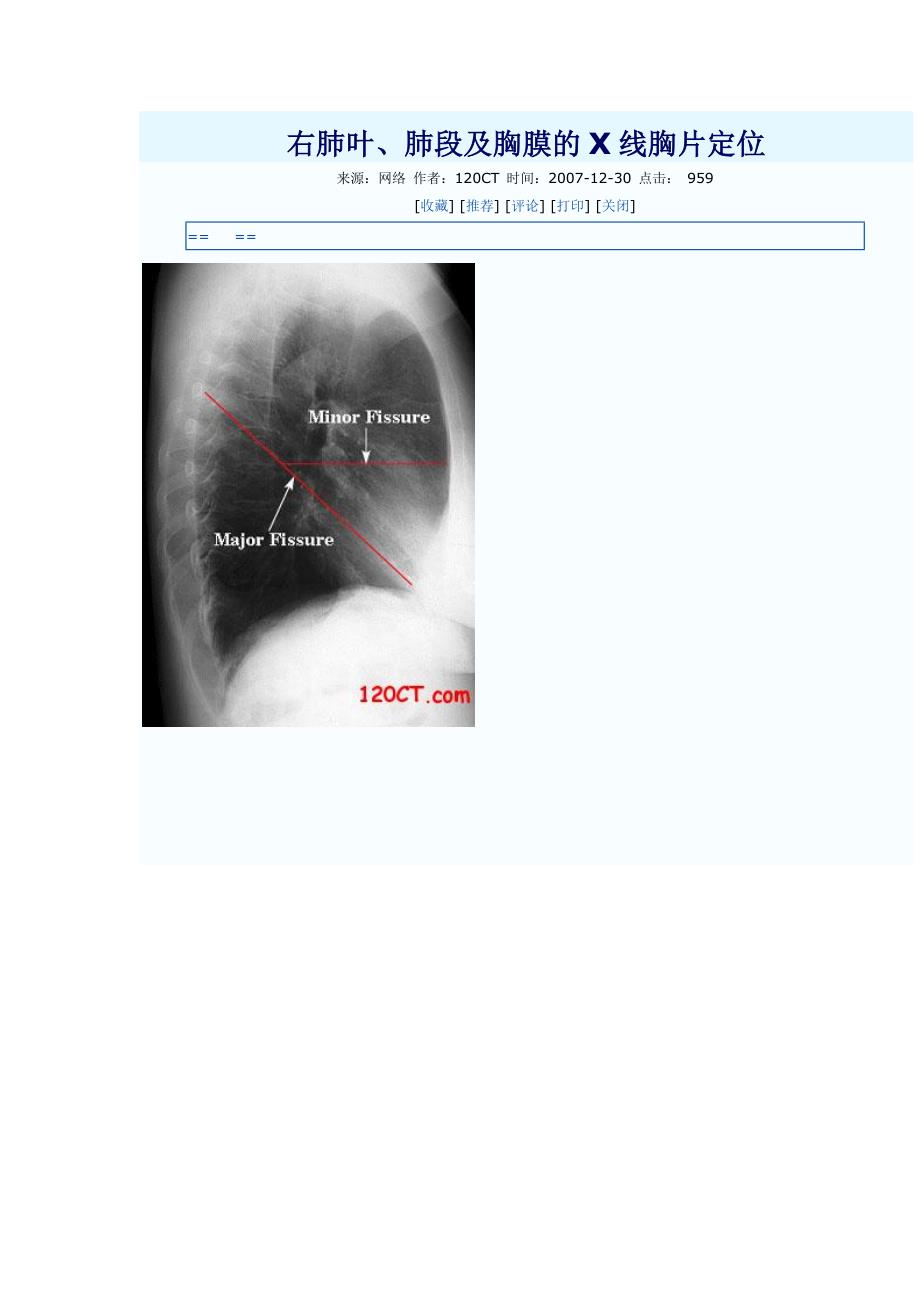 右肺叶、肺段及胸膜的x线胸片定位_第1页