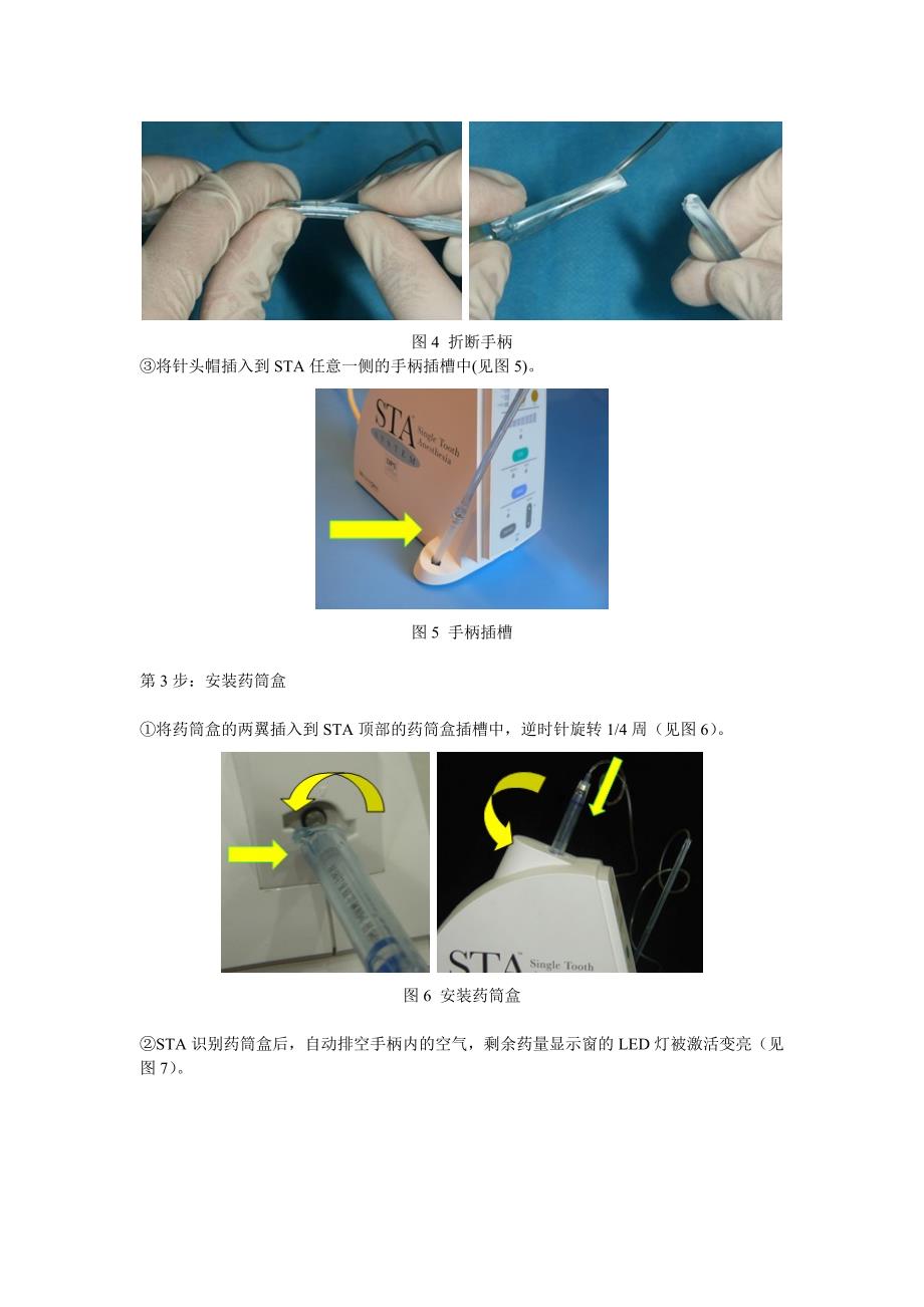 计算机控制下的无痛麻醉注射系统(c-clads)(校对后)_第3页