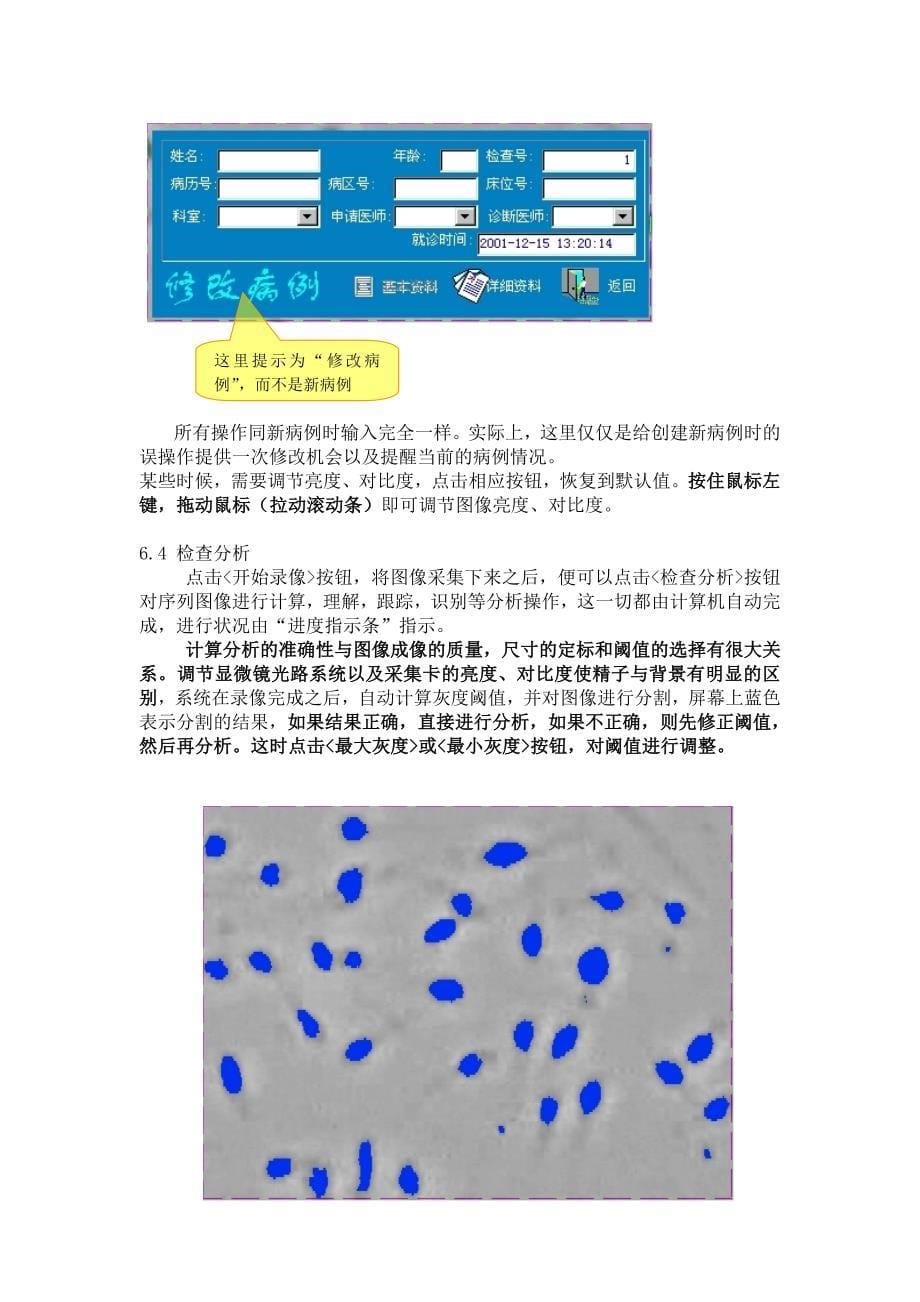 精液常规及质量分析_第5页